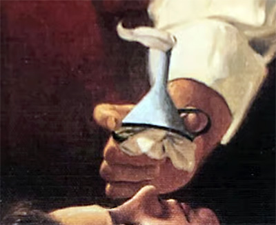 Queen Victoria receiving chloroform drops via handkerchief