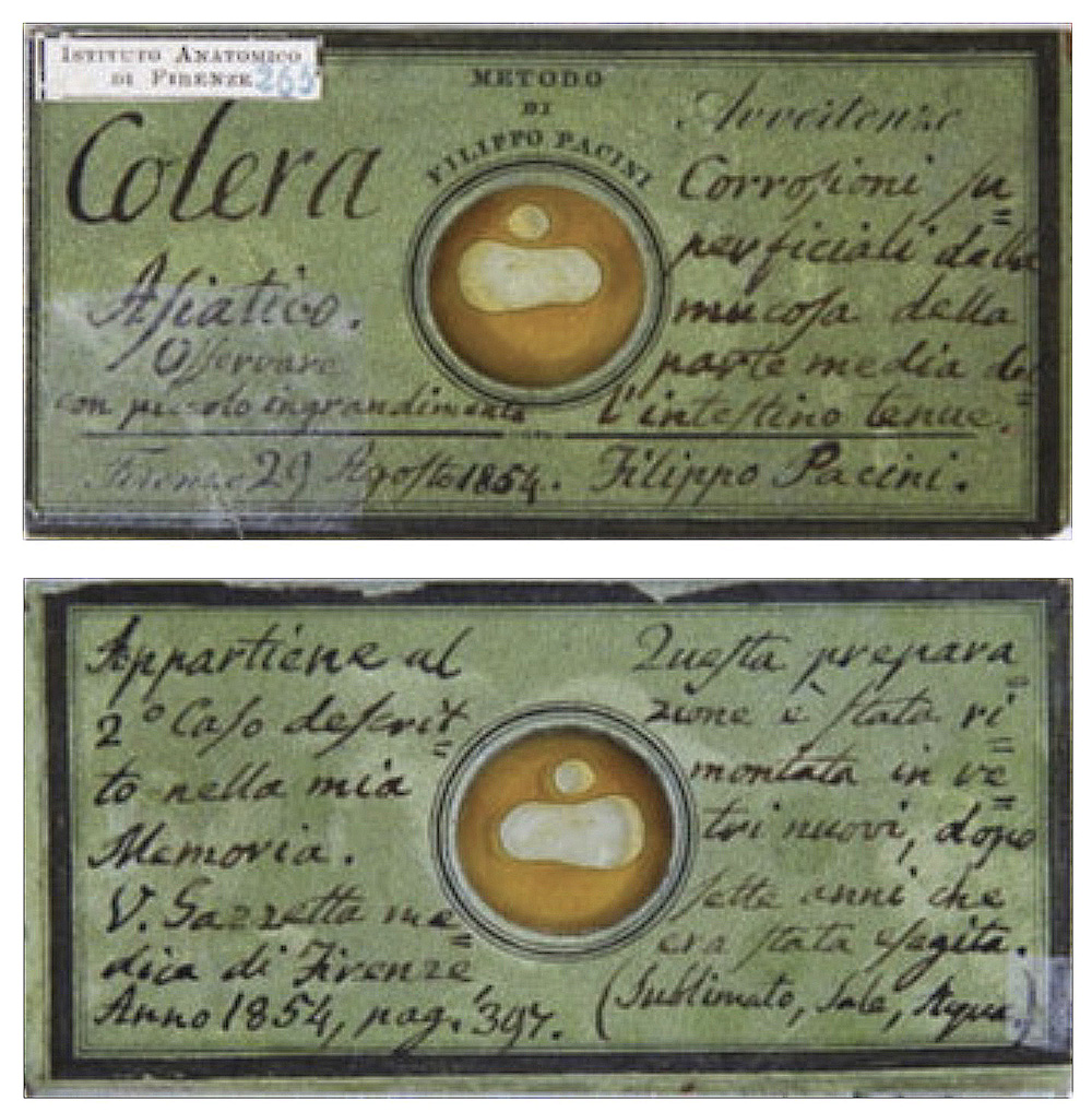cholera plate front and back