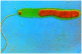 Vibrio cholerae bacterium