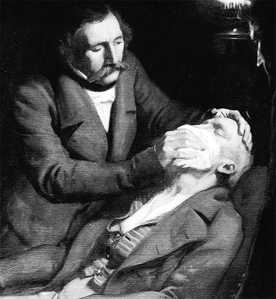 cloth over nose and mouth for anesthesia