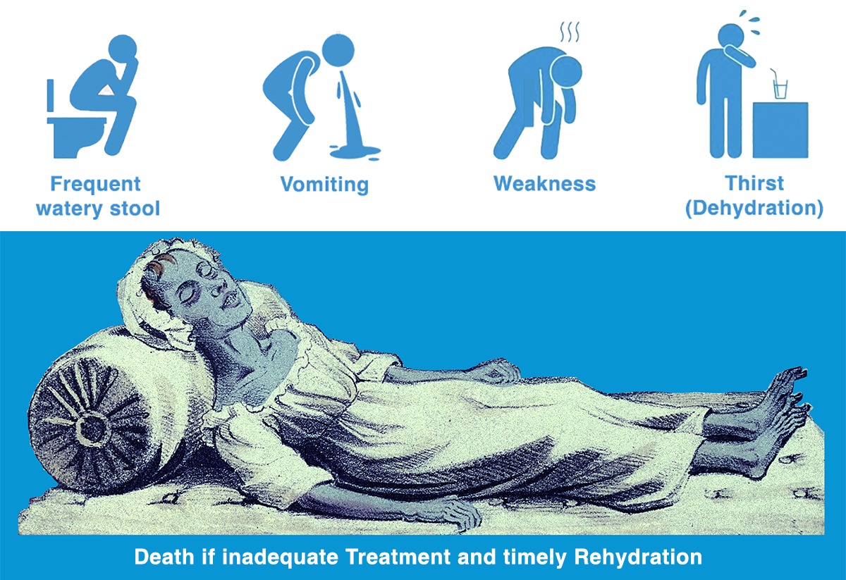 cholera clinical symptom and death